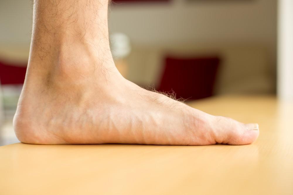 What to Do About Flat Feet