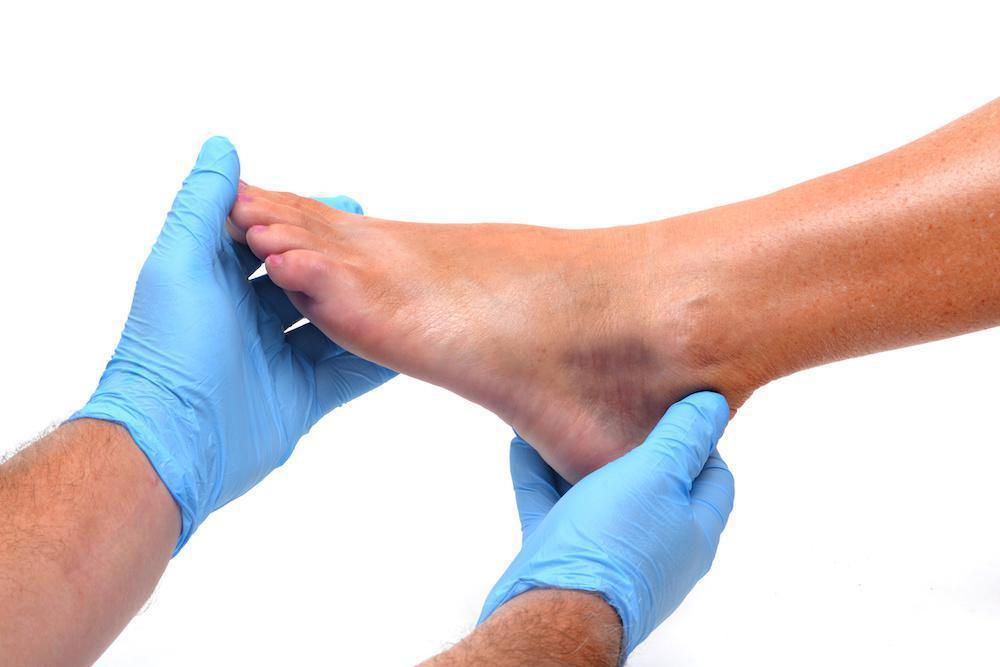 Can a Tendon Tear Heal on Its Own?