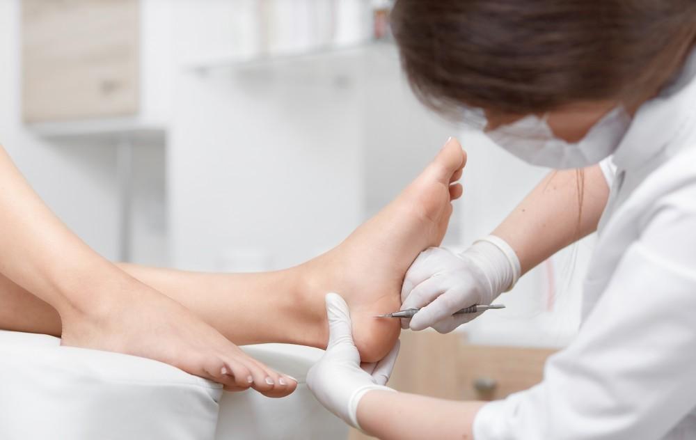  Bothered by Your Warts? We Can Help