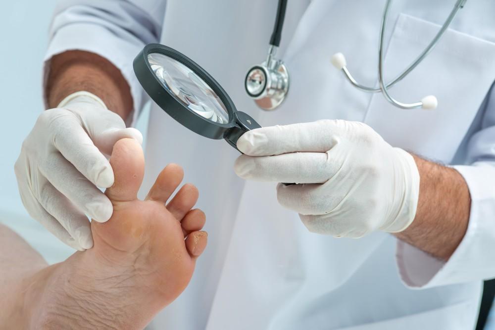 Are Over-the-counter Toenail Fungus Treatments Effective? 