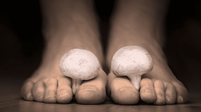 How to Prevent Nail Fungus Infections
